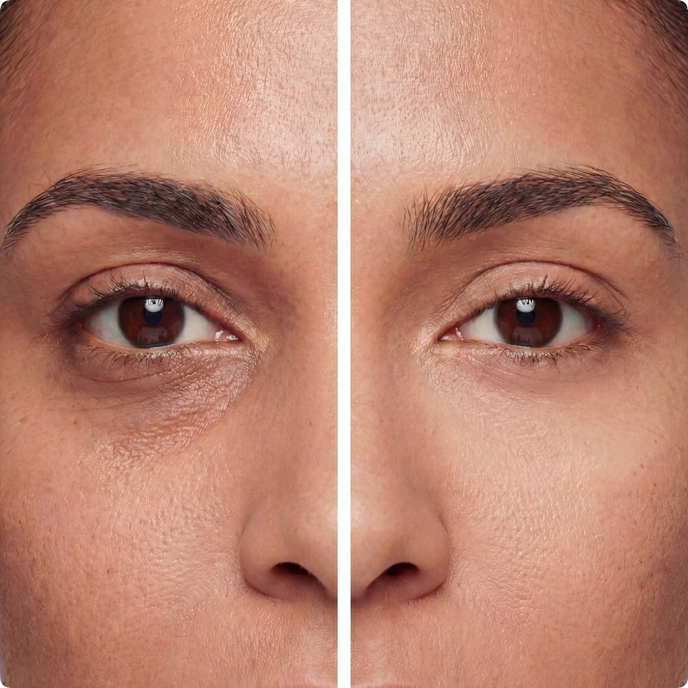 Contorno Occhi al Collagene con Massaggio Elettrico 50g